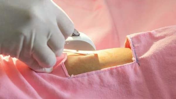 Contraceptive Implant (Implanon NXT®) Insertion & Removal Training
